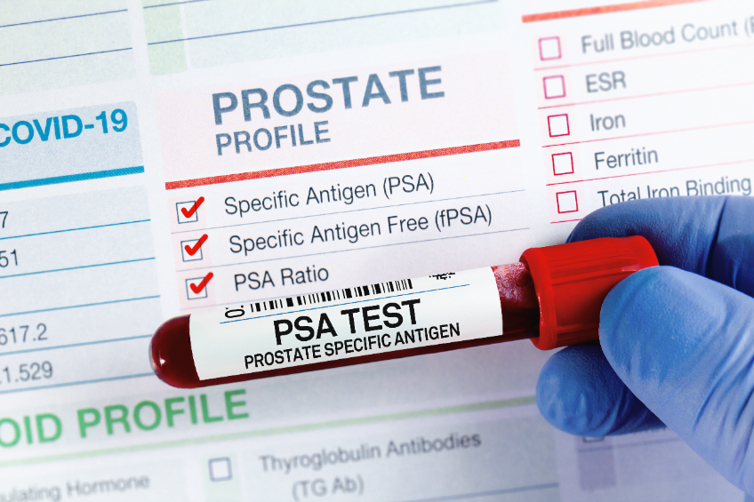 prostate