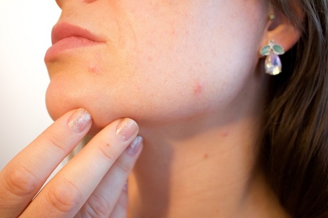 maladies de la peau